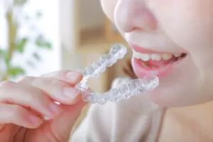 食事や歯磨きの時は取り外しができるのでストレスなく矯正する事ができる